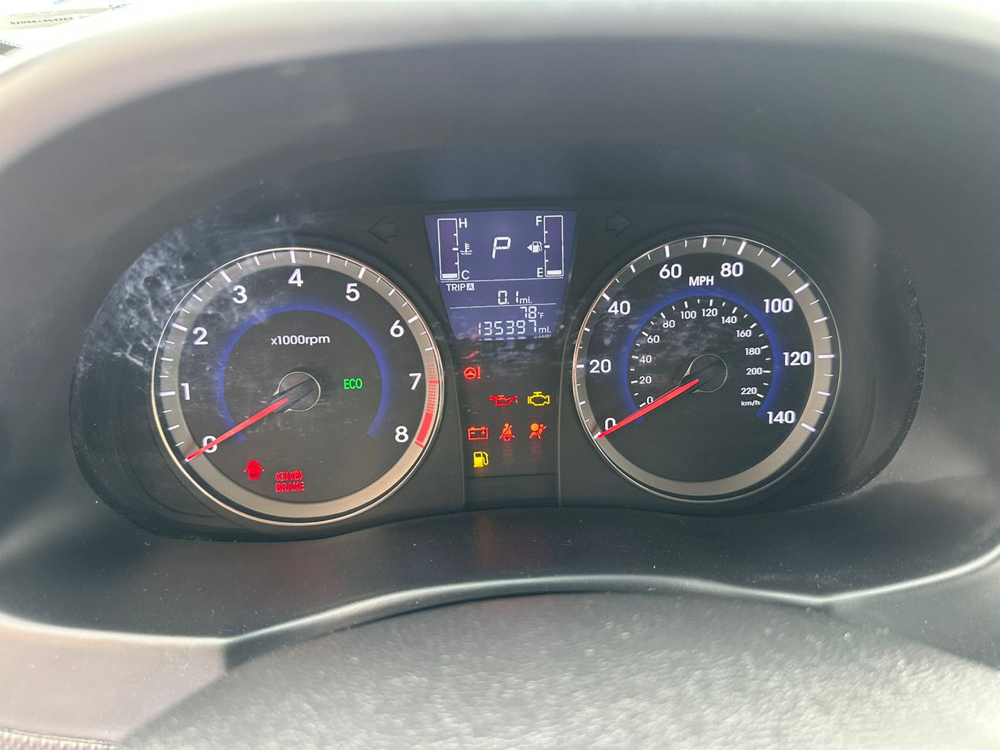 2017 Hyundai ACCEN SE SE VIN: KMHCT5AE4HU325486